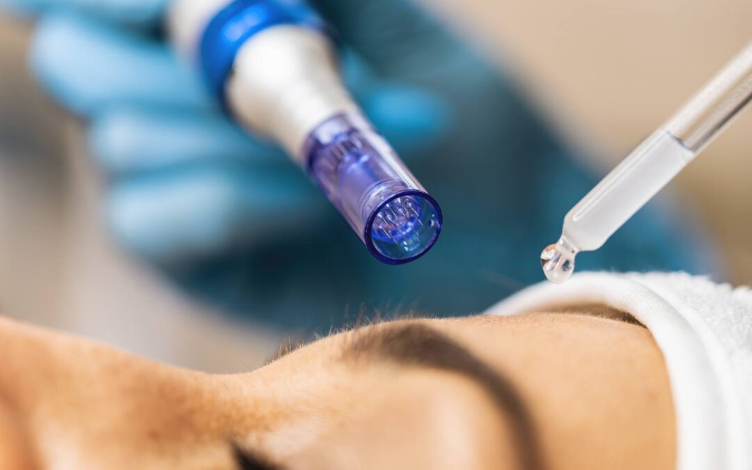 PRP vs. Traditional Facials: Which is Right for Your Skin?